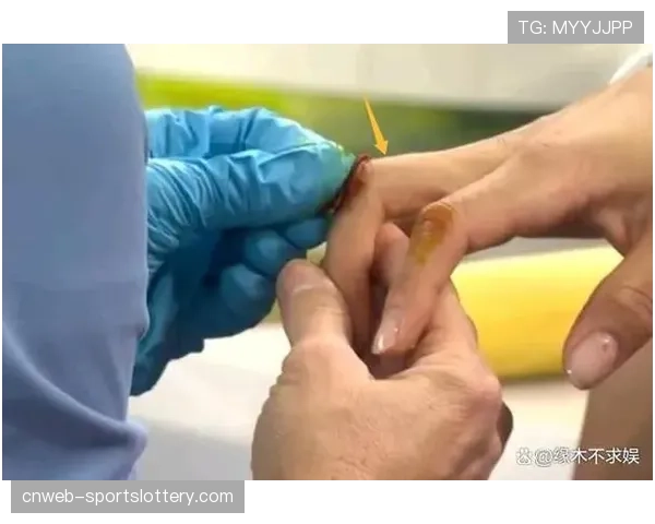 特写：医疗暂停期间，队医为球员受伤手指进行紧急包扎